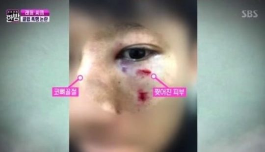 c-k-jpopews-sur-l’affaire-d’agression-de-c-jamm-les-accusés-donnent-leur-version-des-faits